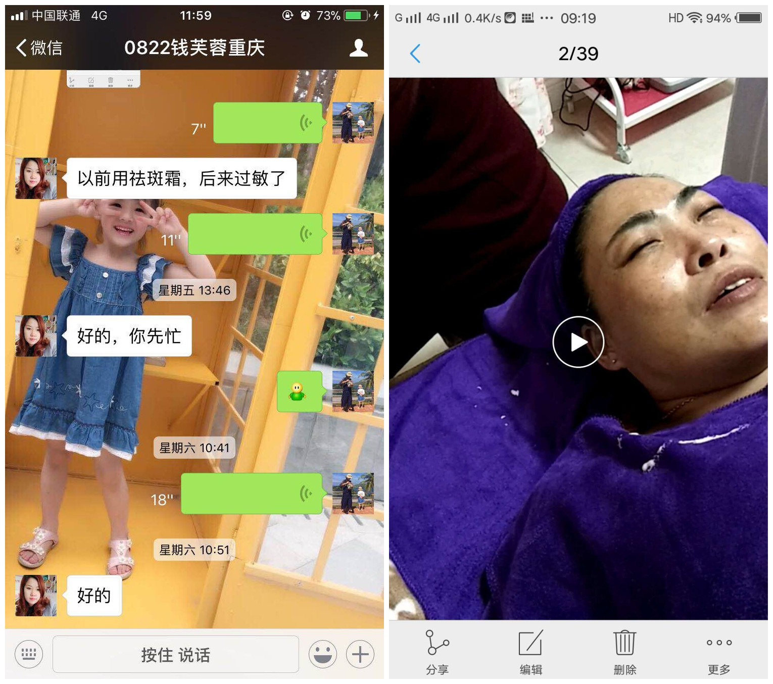 花季传媒APP网站免费进入 “雪肌晶纯系列”   4个月拯救色斑激素脸